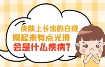 长了白癜风怎样治疗护理