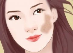 南京市皮肤病研究所：个性化祛斑，美丽不再是梦！