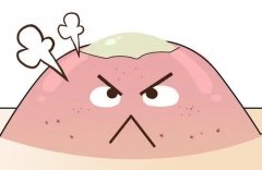 怎么让痘痘快速消炎退红