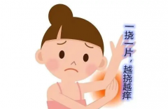 下肢冬季干燥瘙痒怎么回事