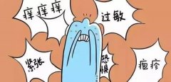 浑身发痒是什么病的前兆